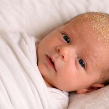 Come togliere crosta lattea neonati: un rimedio delicato ed efficace