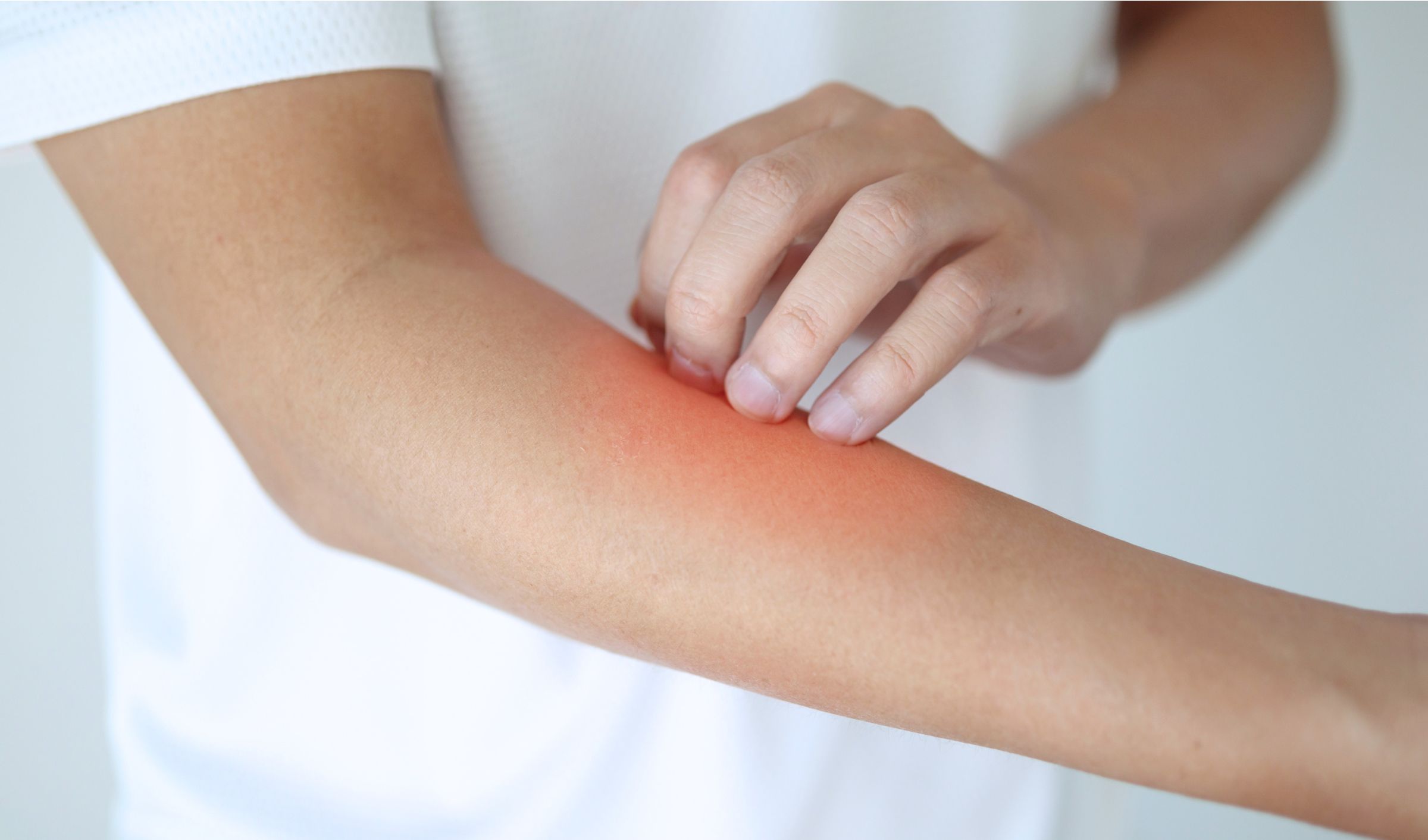 amido di riso per dermatite adulti